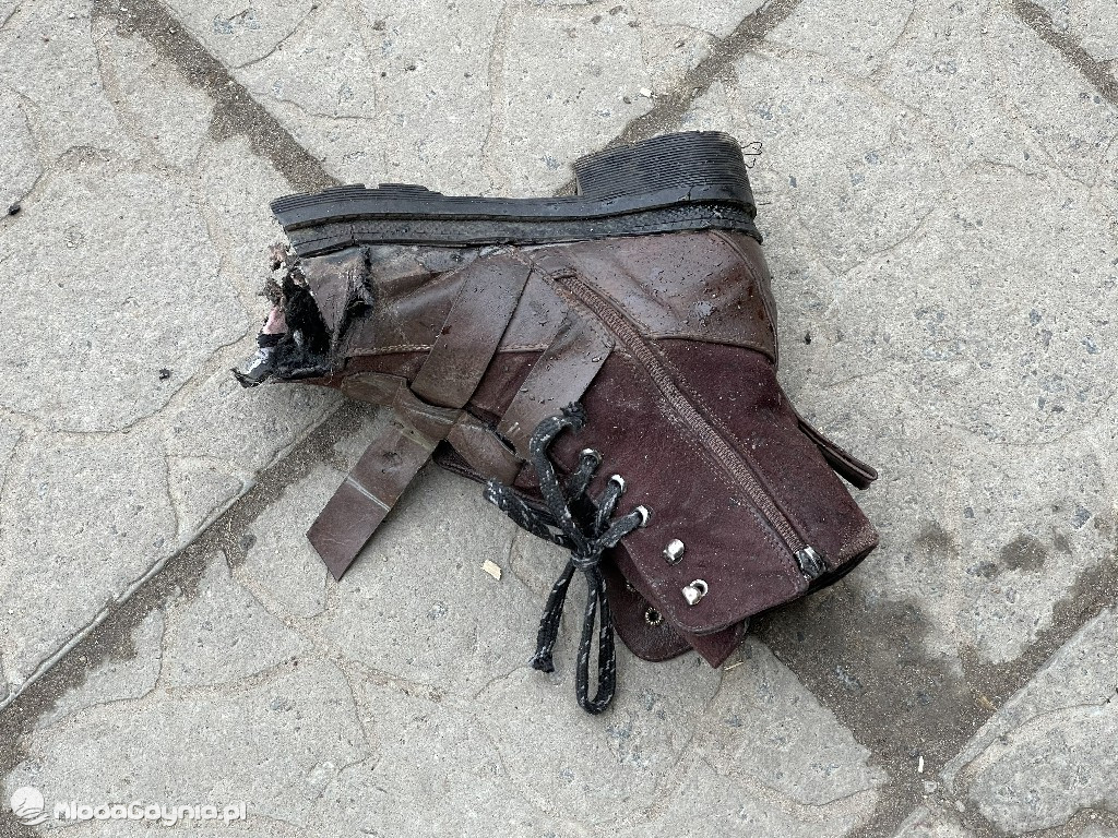 Unikalne zdjęcia z Ukrainy. Zobacz jak wygląda ta wojna!