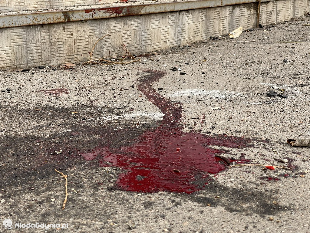 Unikalne zdjęcia z Ukrainy. Zobacz jak wygląda ta wojna!