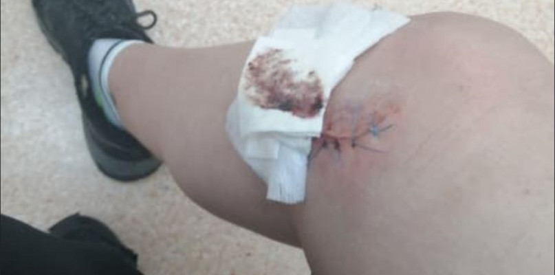 Nie ma komu zdjąć szwów. Chaos w służbie zdrowia. Lekarze boją się pacjentów jak o