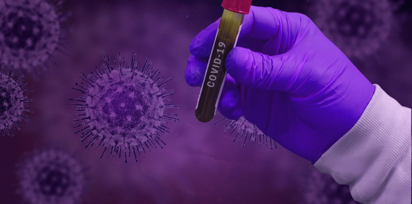 Bezpłatne testy dla medyków. Inicjatywa DIAGNOSTYKI. Badanie na parkingu przy ul. 