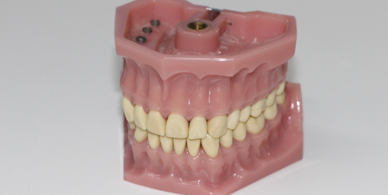 Głęboki zgryz i cofnięta żuchwa - Kompleksowe Leczenie w Adentis Warszawa