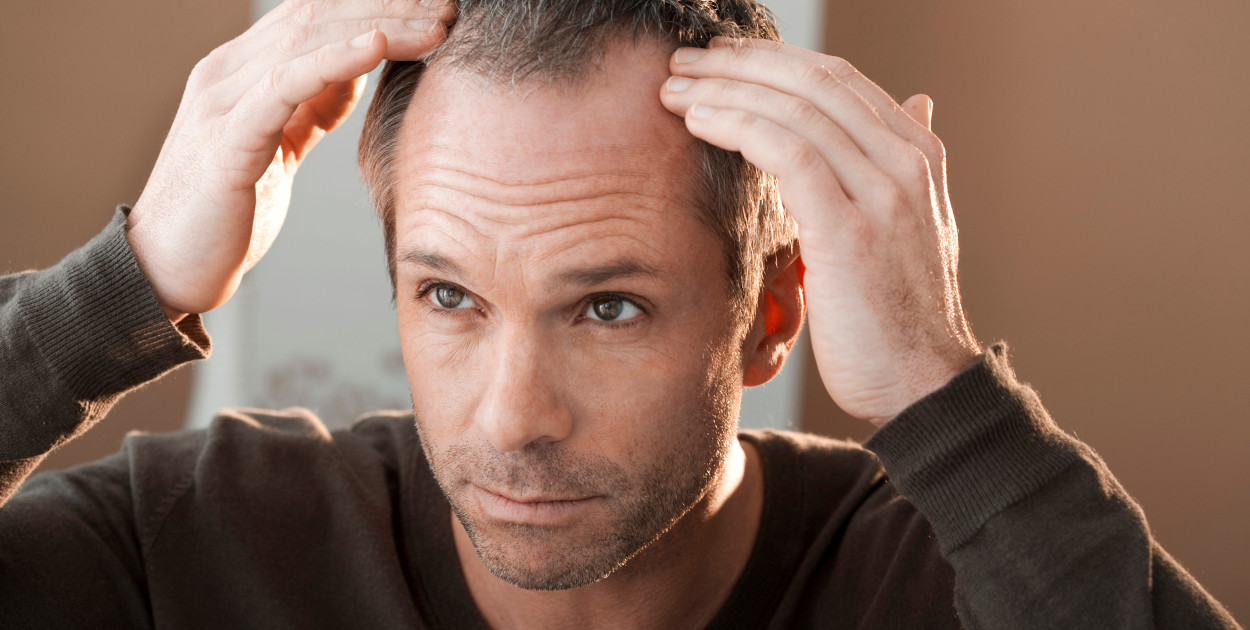 Łysienie – jak je wyleczyć i poprawić swój wygląd? 