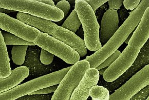 Gdynia/ Bakterie grupy coli w wodzie w kilku dzielnicach-78446