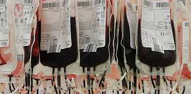 Centra Krwi w województwie pomorskim notują coraz niższe wyniki finansowe