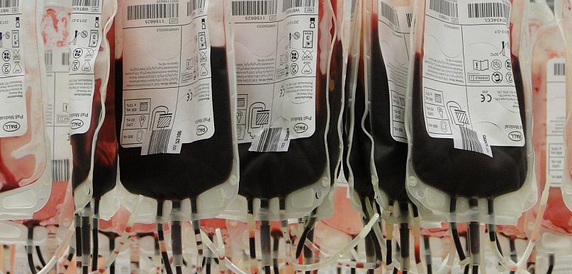 Centra Krwi w województwie pomorskim notują coraz niższe wyniki finansowe